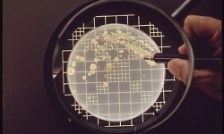 Microbial Cell Enumeration